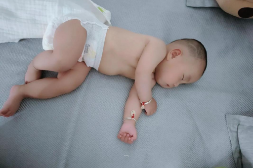 老河口宝宝脸上有白色斑块